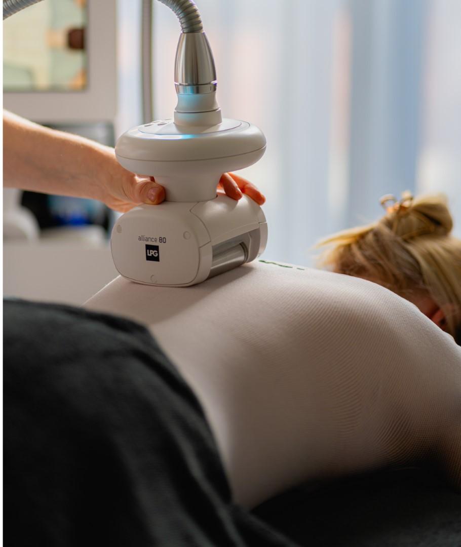 LPG endormologie lichaamszone behandeling