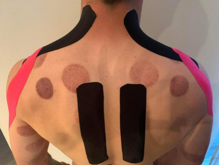 medical tape soorten en toepassing